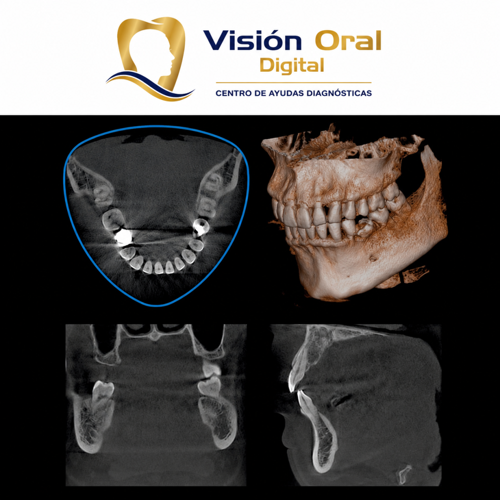 tomografia-acacias-visionoral